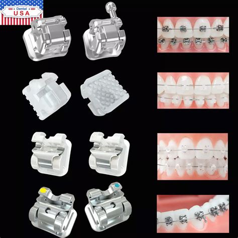 gambar bracket metal mini orthodontic|mini master brackets.